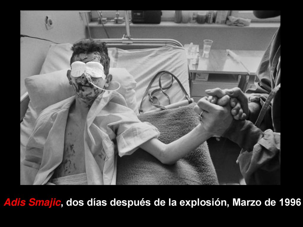 Adis Smajic, dos días después de la explosión, Marzo de 1996