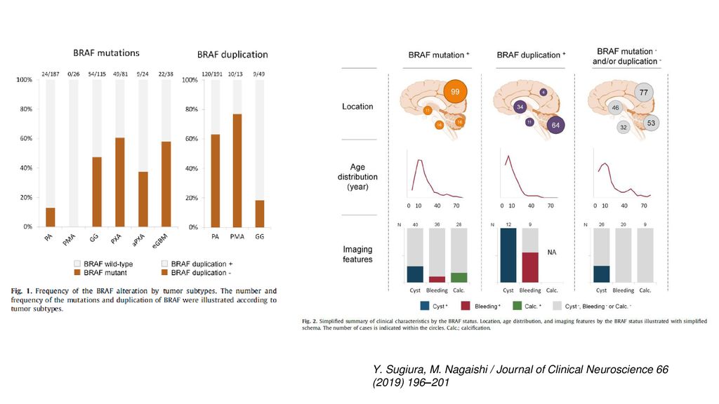 Y. Sugiura, M. Nagaishi / Journal of Clinical Neuroscience 66 (2019) 196–201