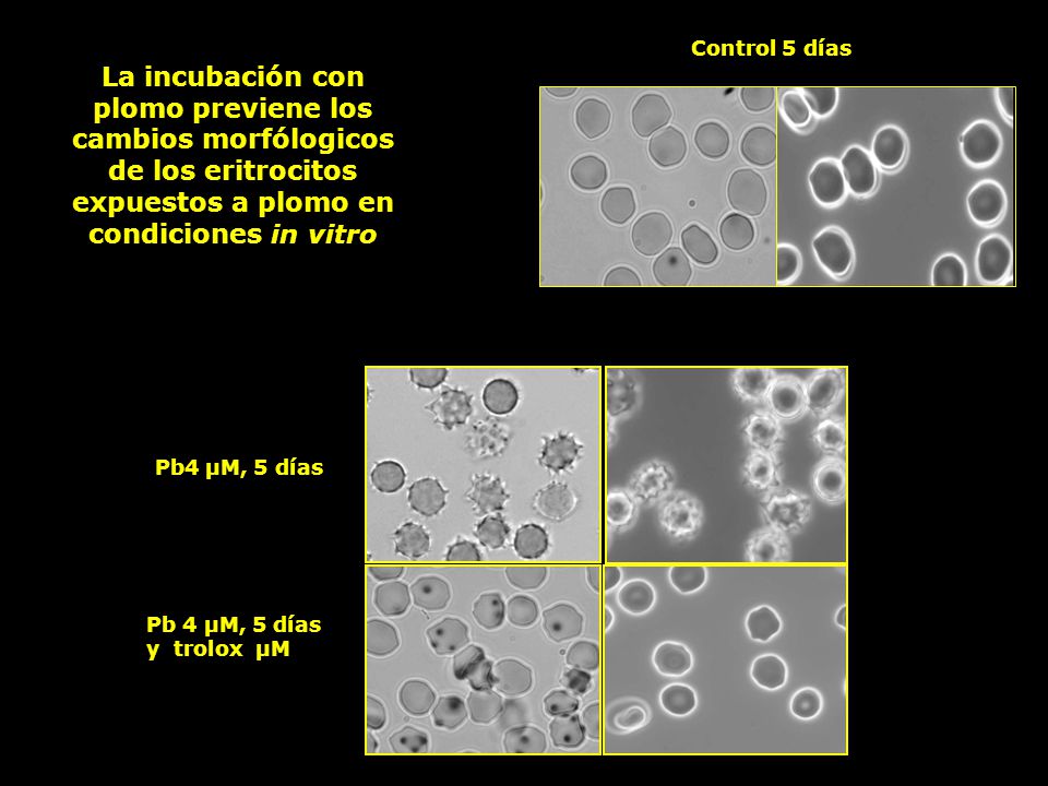 Control 5 días La incubación con plomo previene los cambios morfólogicos de los eritrocitos expuestos a plomo en condiciones in vitro.