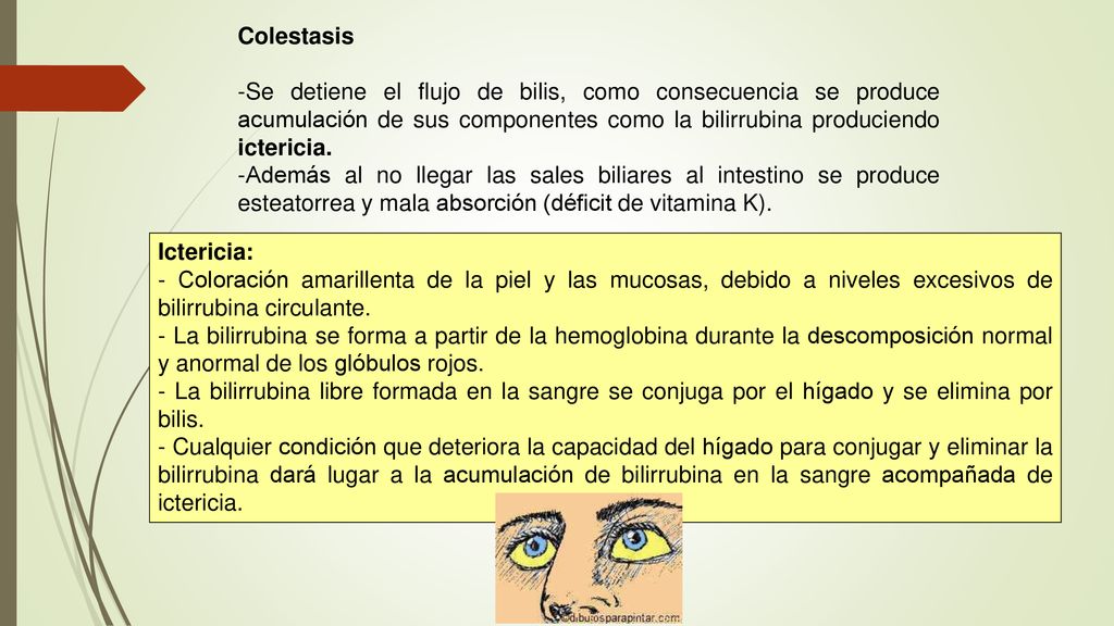 Colestasis Se detiene el flujo de bilis, como consecuencia se produce acumulación de sus componentes como la bilirrubina produciendo ictericia.