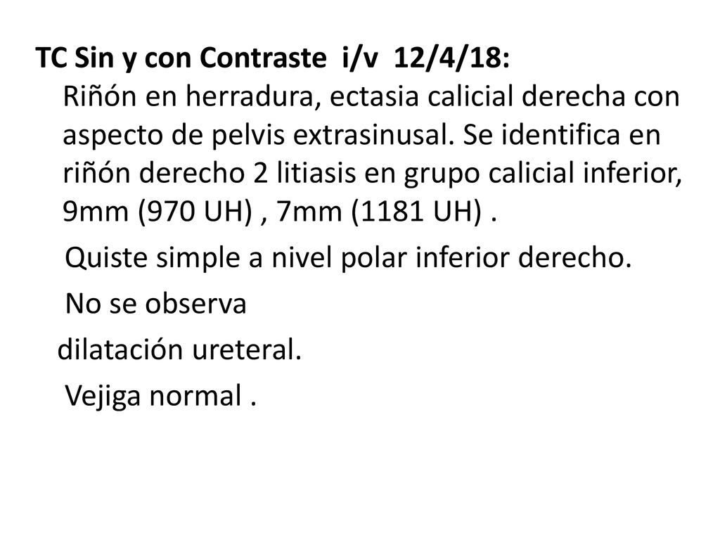 TC Sin y con Contraste i/v 12/4/18: Riñón en herradura, ectasia calicial derecha con aspecto de pelvis extrasinusal.
