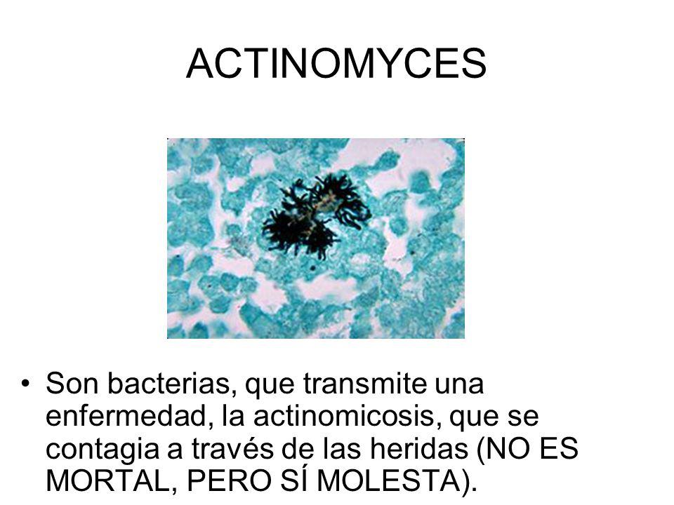 ACTINOMYCES Son bacterias, que transmite una enfermedad, la actinomicosis, que se contagia a través de las heridas (NO ES MORTAL, PERO SÍ MOLESTA).