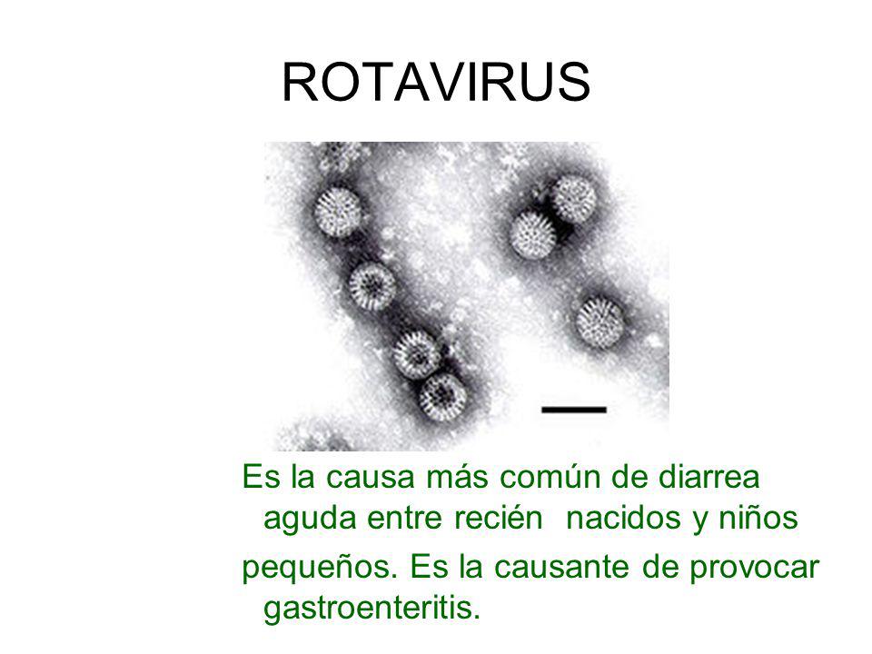 ROTAVIRUS Es la causa más común de diarrea aguda entre recién nacidos y niños.