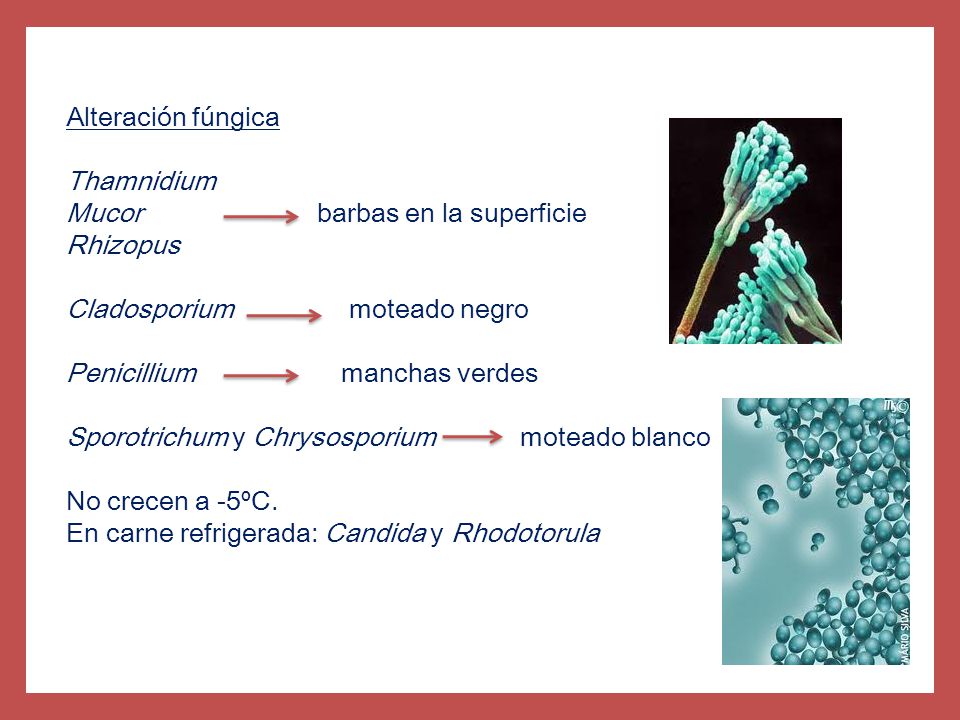 Mucor barbas en la superficie Rhizopus Cladosporium moteado negro