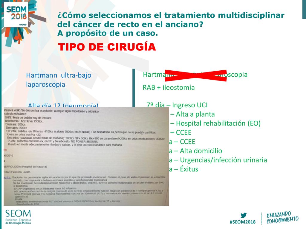 ¿Cómo seleccionamos el tratamiento multidisciplinar del cáncer de recto en el anciano