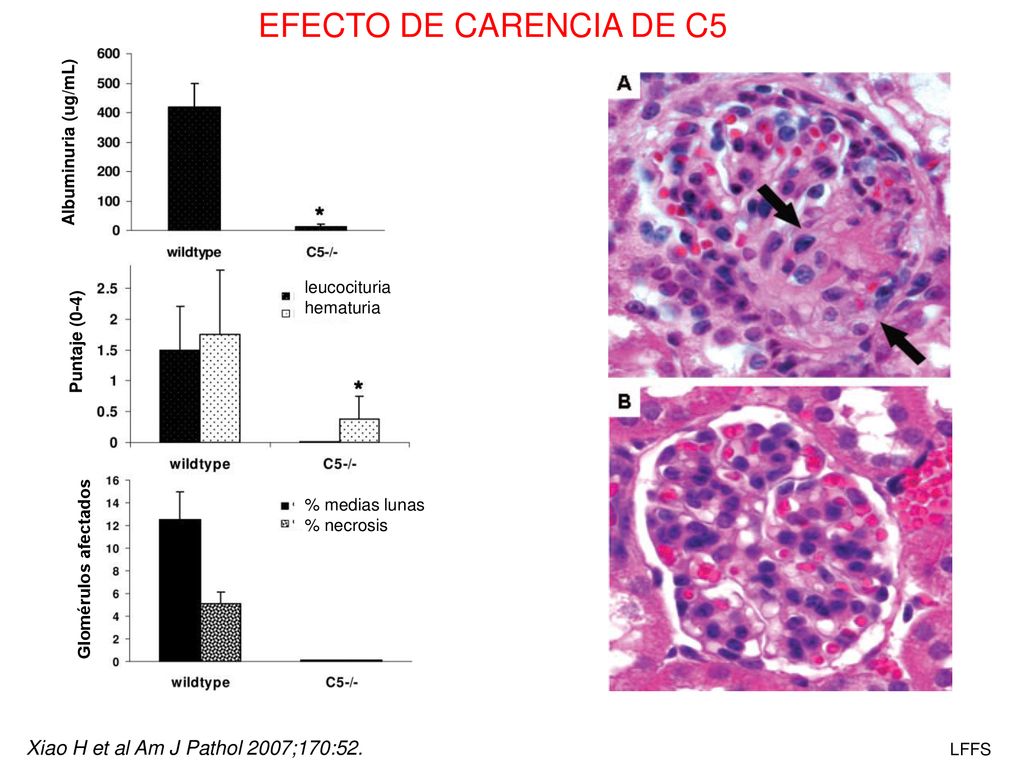 EFECTO DE CARENCIA DE C5 Xiao H et al Am J Pathol 2007;170:52.
