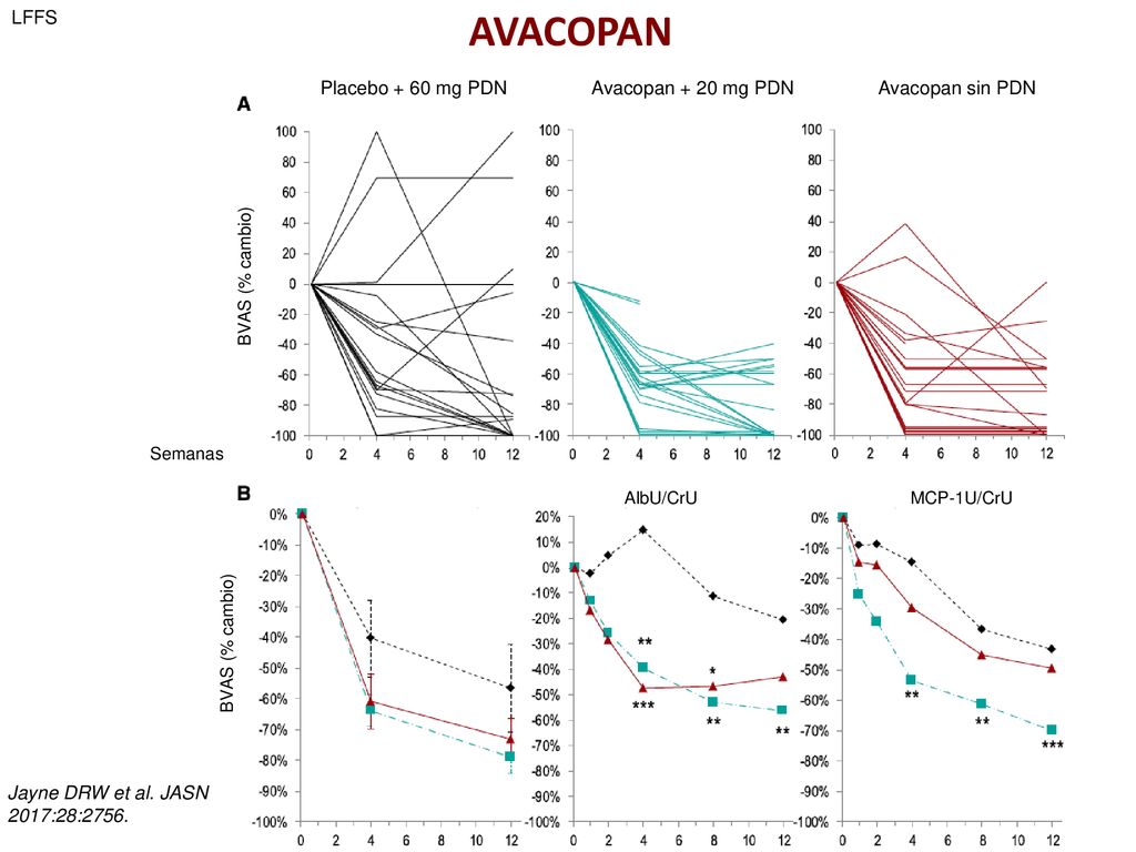 LFFS AVACOPAN. Placebo + 60 mg PDN Avacopan + 20 mg PDN Avacopan sin PDN.