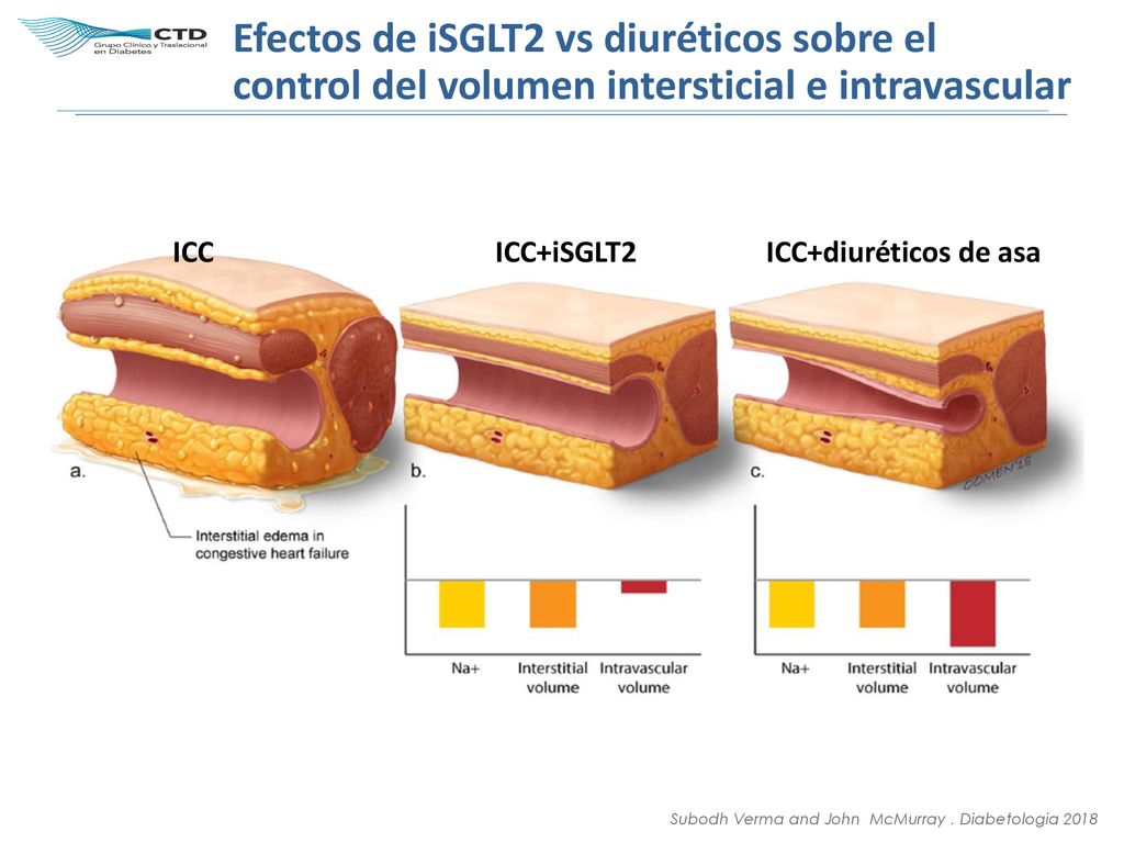 Efectos de iSGLT2 vs diuréticos sobre el control del volumen intersticial e intravascular