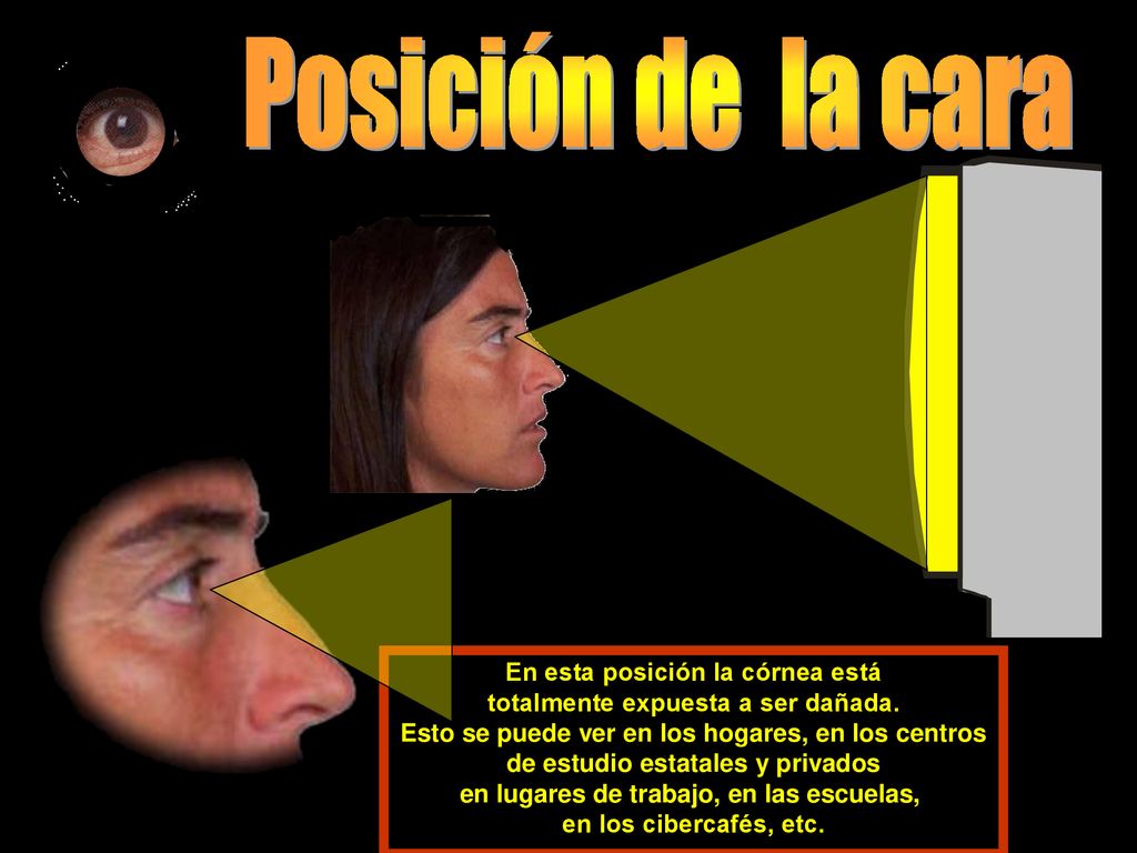 Posición de la cara En esta posición la córnea está