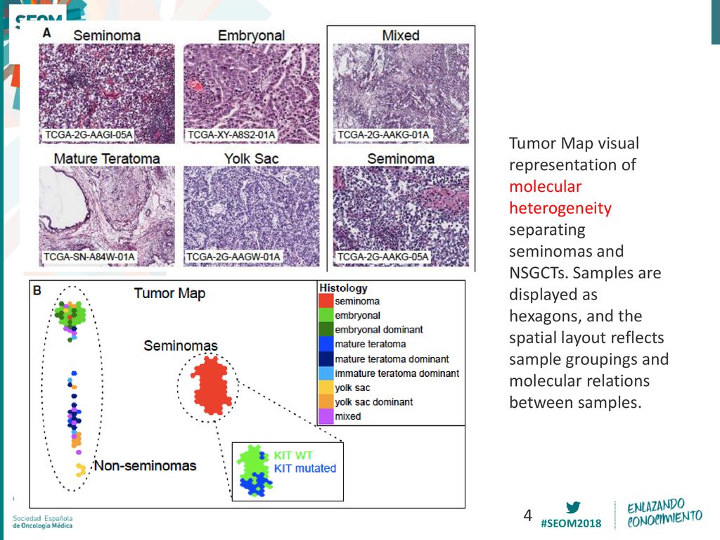 Tumor Map visual representation of molecular heterogeneity separating seminomas and NSGCTs. Samples are displayed as hexagons, and the spatial layout reflects sample groupings and molecular relations between samples.