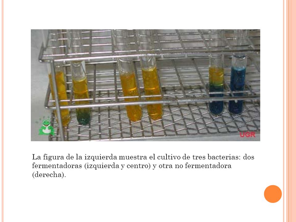 La figura de la izquierda muestra el cultivo de tres bacterias: dos fermentadoras (izquierda y centro) y otra no fermentadora (derecha).
