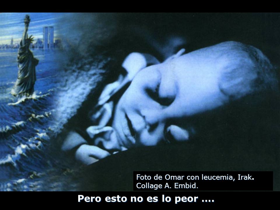 Pero esto no es lo peor …. Foto de Omar con leucemia, Irak.