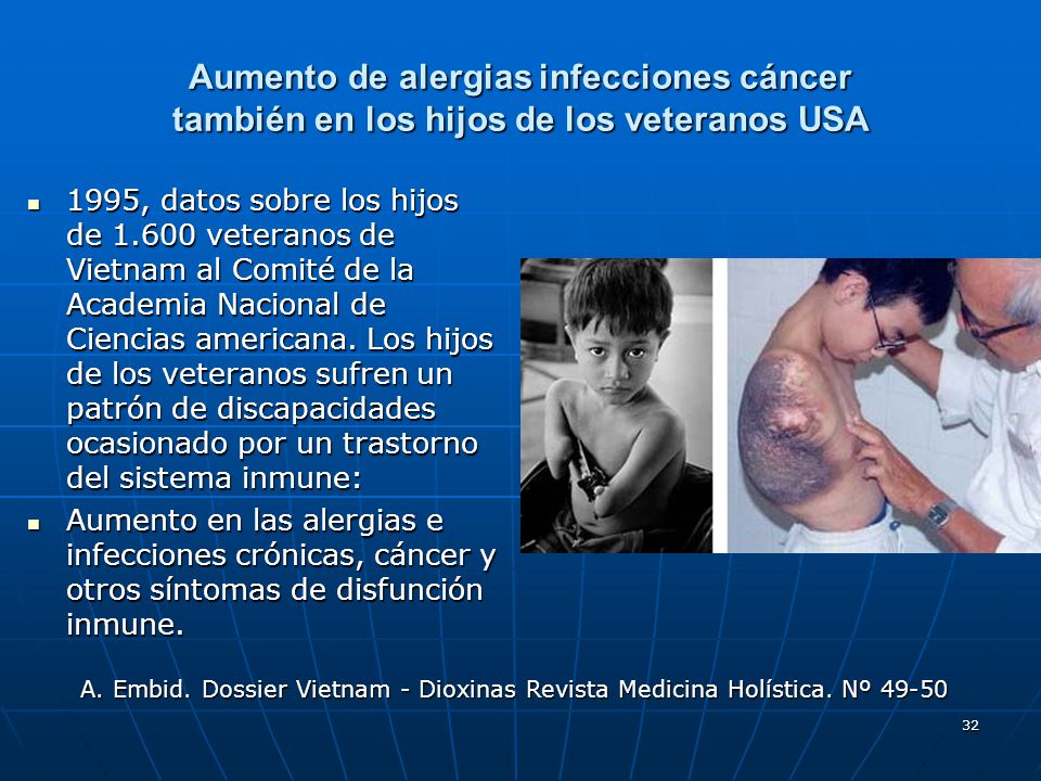 Aumento de alergias infecciones cáncer también en los hijos de los veteranos USA