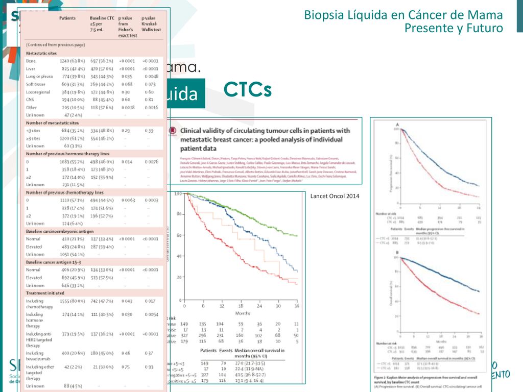 Biopsia Líquida CTCs Cáncer de Mama. Biopsia Líquida en Cáncer de Mama