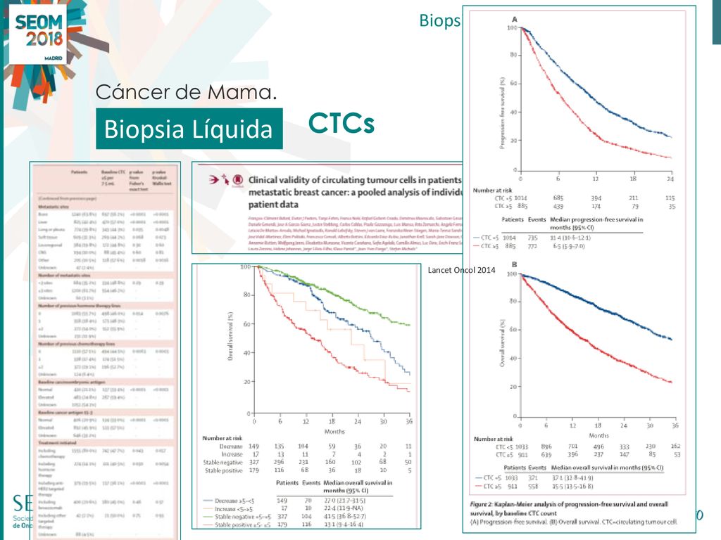 Biopsia Líquida CTCs Cáncer de Mama. Biopsia Líquida en Cáncer de Mama