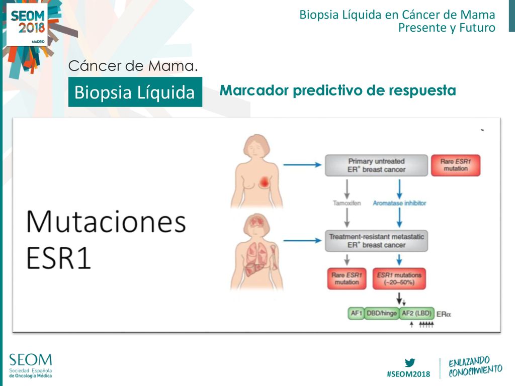 Biopsia Líquida Cáncer de Mama. Marcador predictivo de respuesta