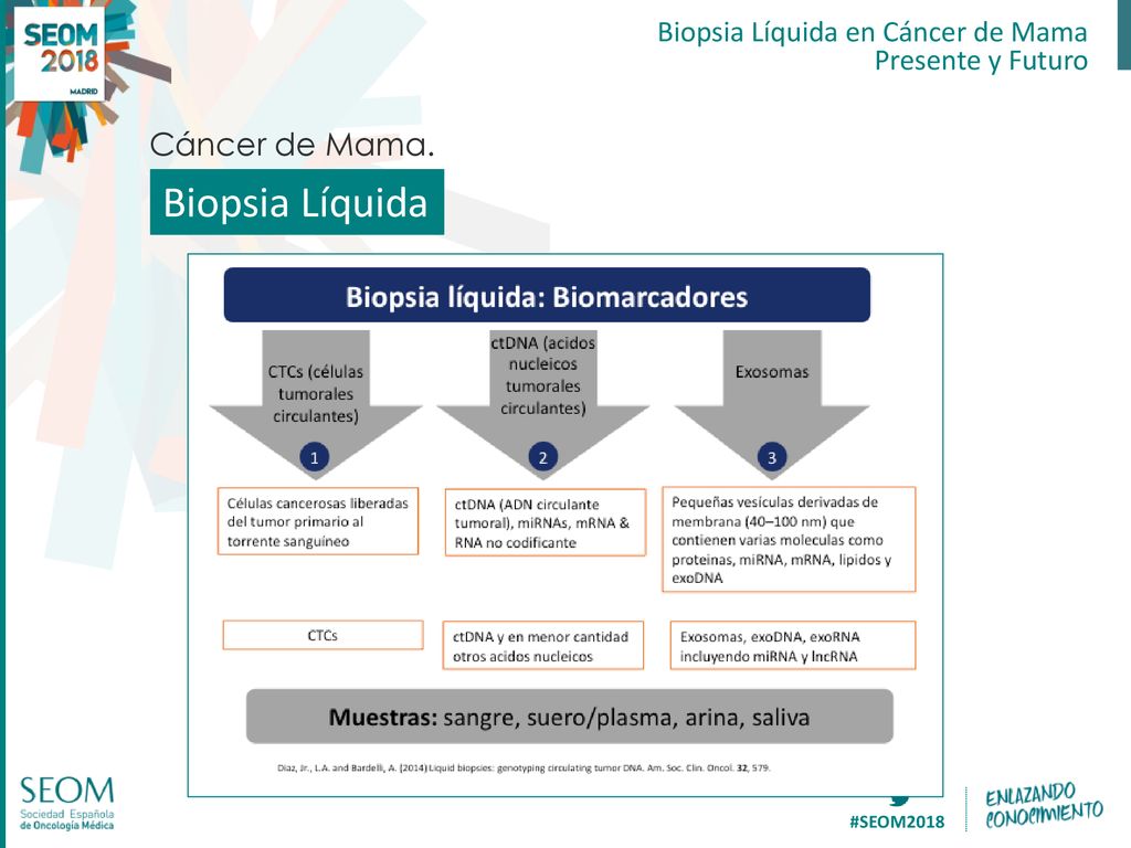 Biopsia Líquida Cáncer de Mama. Biopsia Líquida en Cáncer de Mama