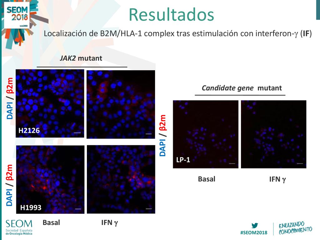 Resultados Localización de B2M/HLA-1 complex tras estimulación con interferon-g (IF) JAK2 mutant. Candidate gene mutant.