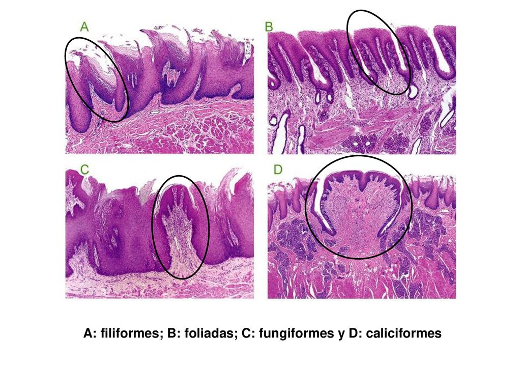A: filiformes; B: foliadas; C: fungiformes y D: caliciformes