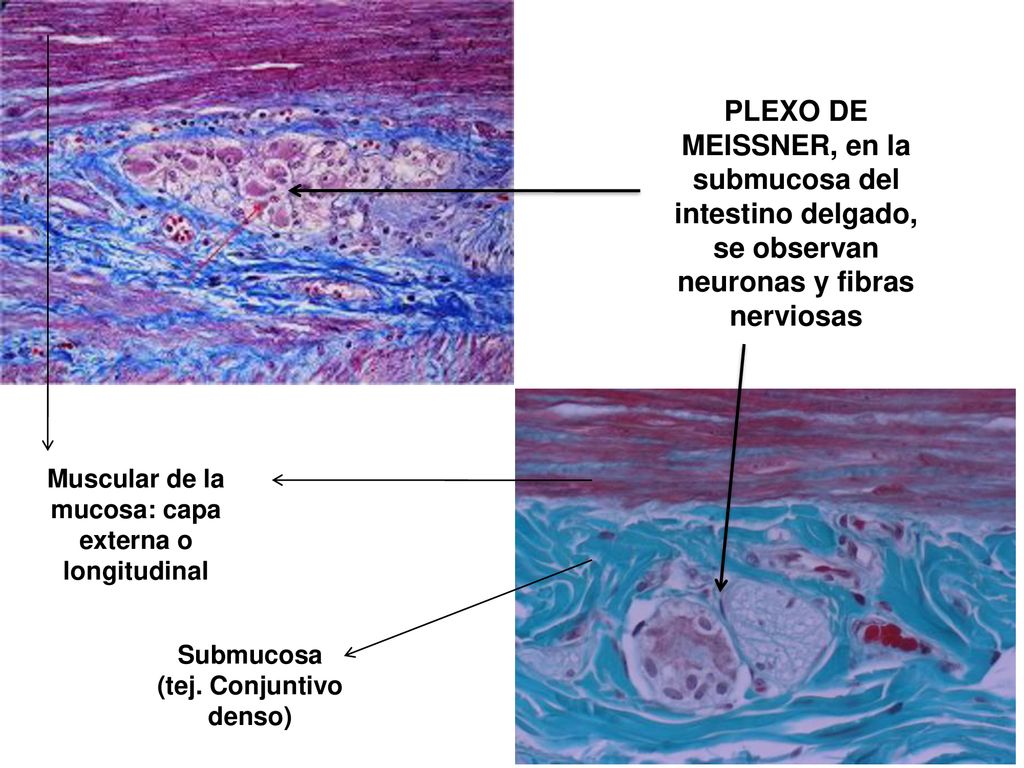 PLEXO DE MEISSNER, en la submucosa del intestino delgado, se observan neuronas y fibras nerviosas