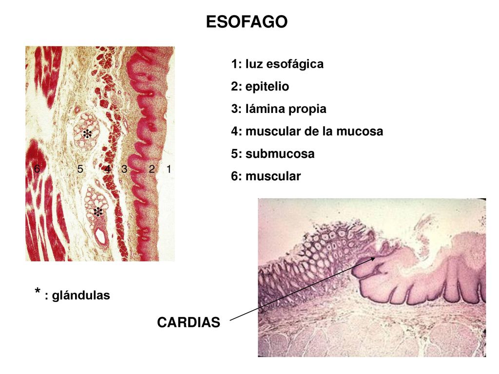 ESOFAGO * : glándulas CARDIAS 1: luz esofágica 2: epitelio