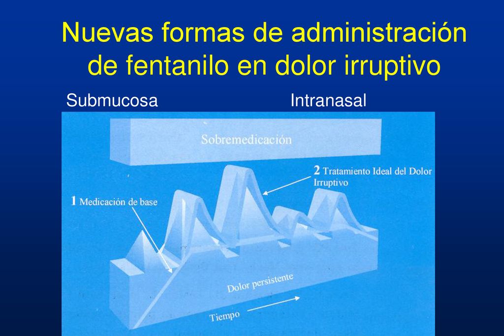 Nuevas formas de administración de fentanilo en dolor irruptivo