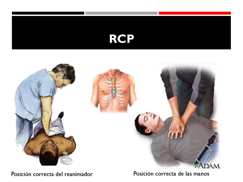 RCP Posición correcta del reanimador Posición correcta de las manos