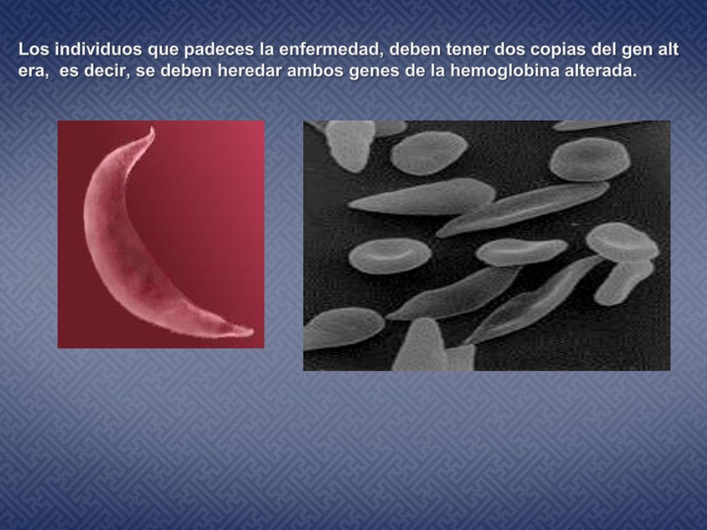 Los individuos que padeces la enfermedad, deben tener dos copias del gen altera, es decir, se deben heredar ambos genes de la hemoglobina alterada.