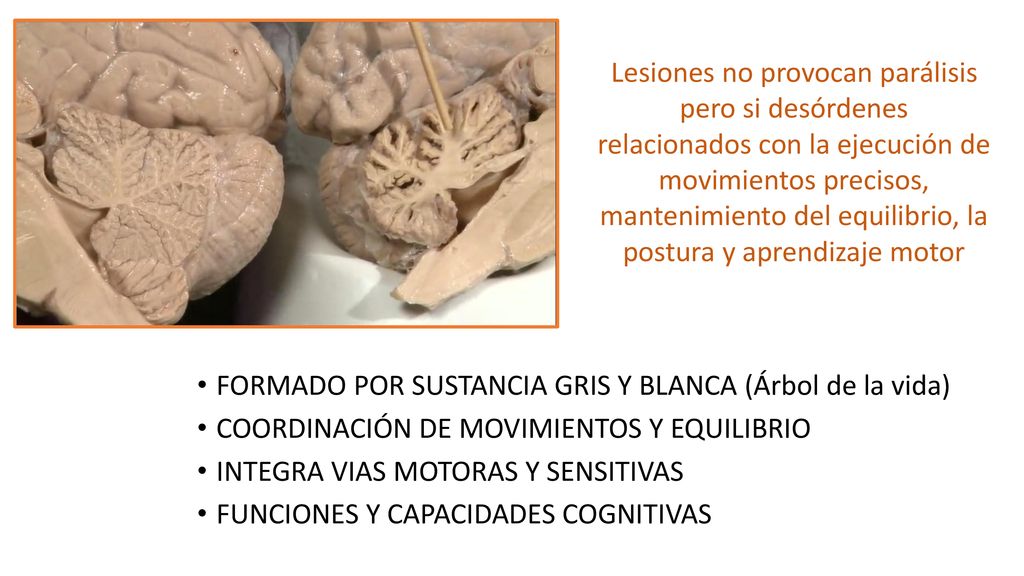 Lesiones no provocan parálisis pero si desórdenes relacionados con la ejecución de movimientos precisos, mantenimiento del equilibrio, la postura y aprendizaje motor