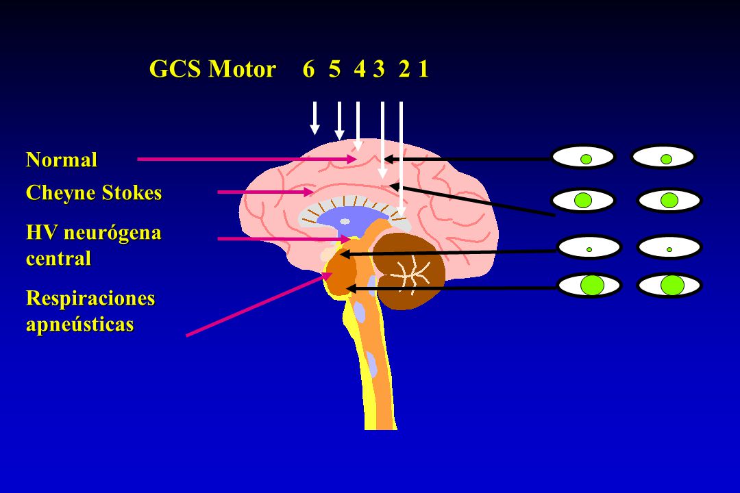 GCS Motor Normal Cheyne Stokes HV neurógena central