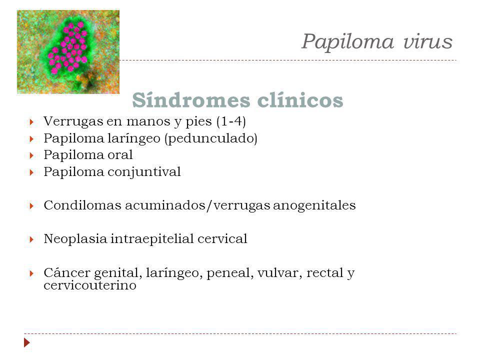Papiloma virus Síndromes clínicos Verrugas en manos y pies (1-4)