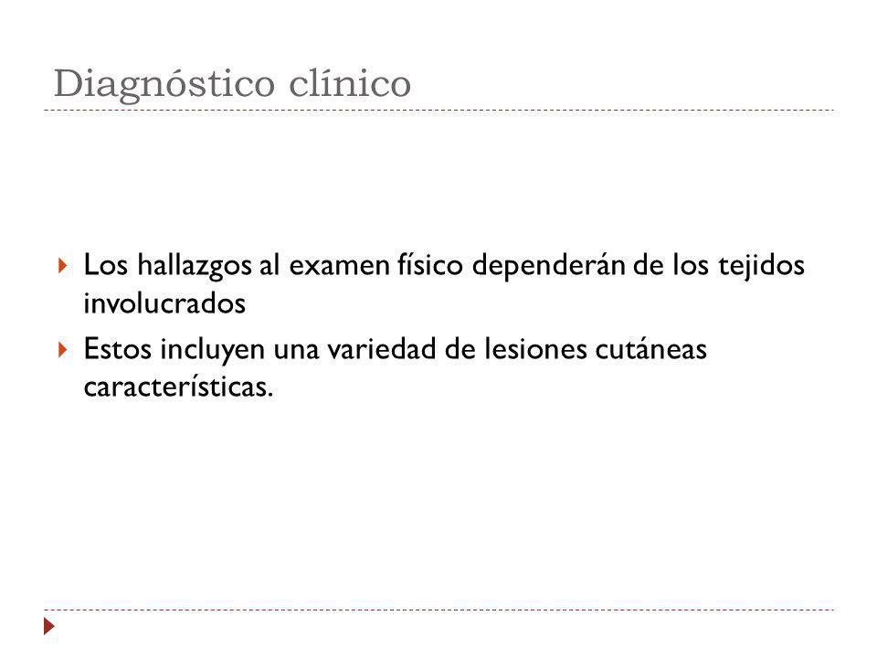 Diagnóstico clínico Los hallazgos al examen físico dependerán de los tejidos involucrados.