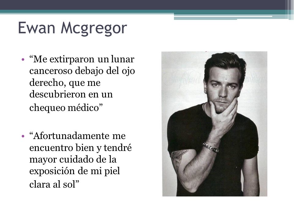 Ewan Mcgregor Me extirparon un lunar canceroso debajo del ojo derecho, que me descubrieron en un chequeo médico