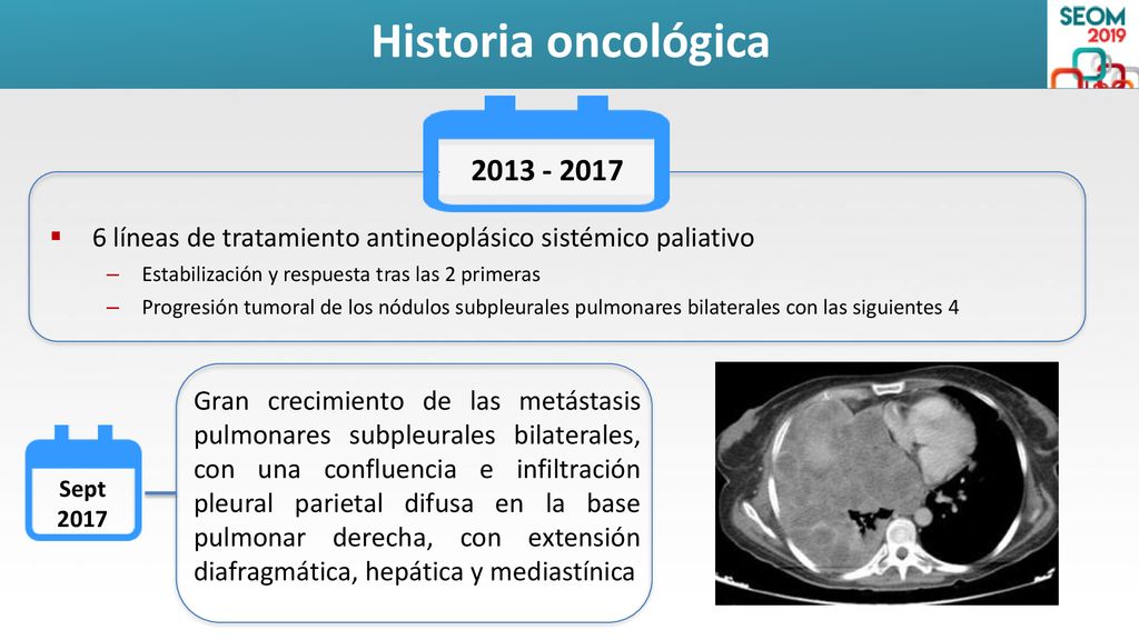 Historia oncológica líneas de tratamiento antineoplásico sistémico paliativo. Estabilización y respuesta tras las 2 primeras.