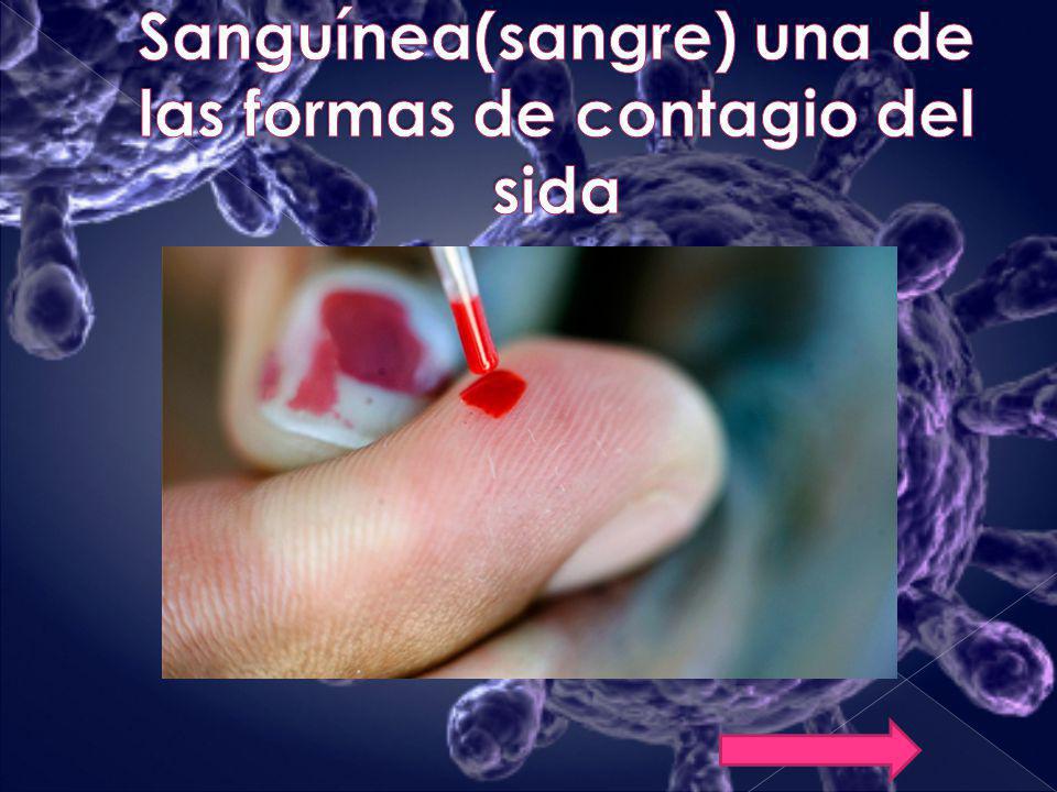 Sanguínea(sangre) una de las formas de contagio del sida