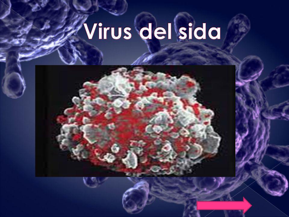 Virus del sida