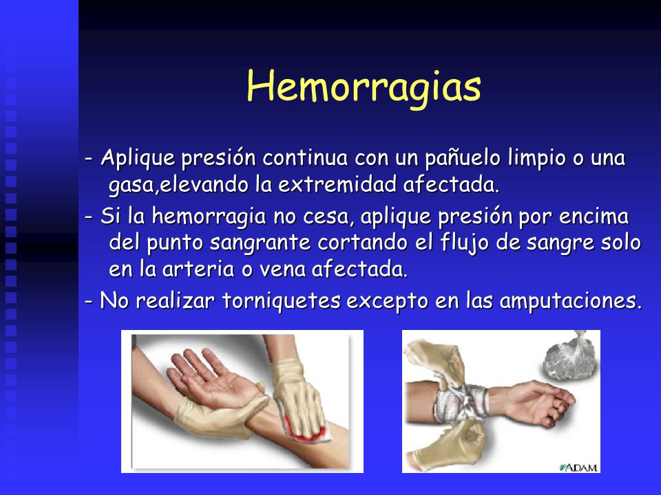 Hemorragias - Aplique presión continua con un pañuelo limpio o una gasa,elevando la extremidad afectada.