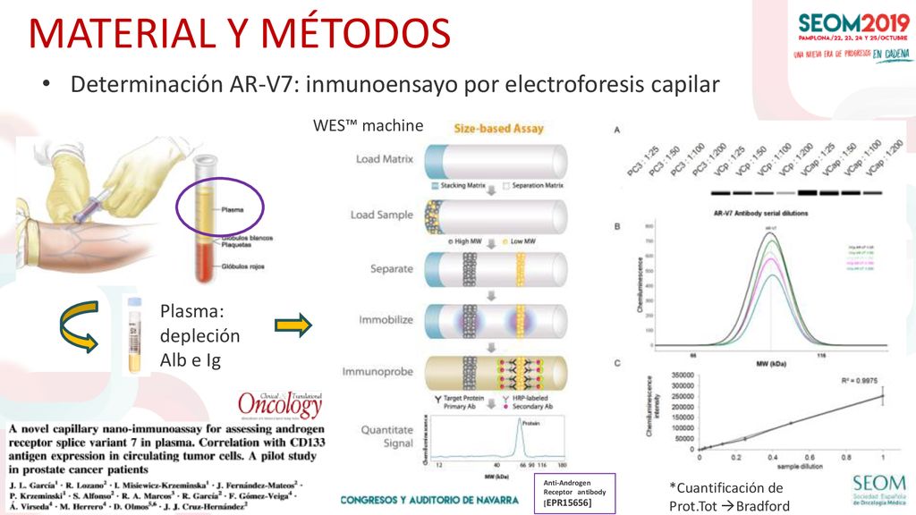 MATERIAL Y MÉTODOS Determinación AR-V7: inmunoensayo por electroforesis capilar. WES™ machine. Plasma: depleción Alb e Ig.