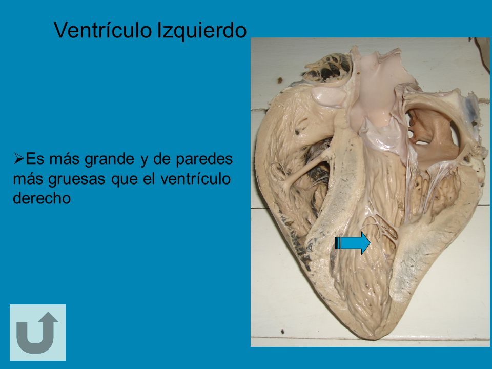 Ventrículo Izquierdo Es más grande y de paredes más gruesas que el ventrículo derecho