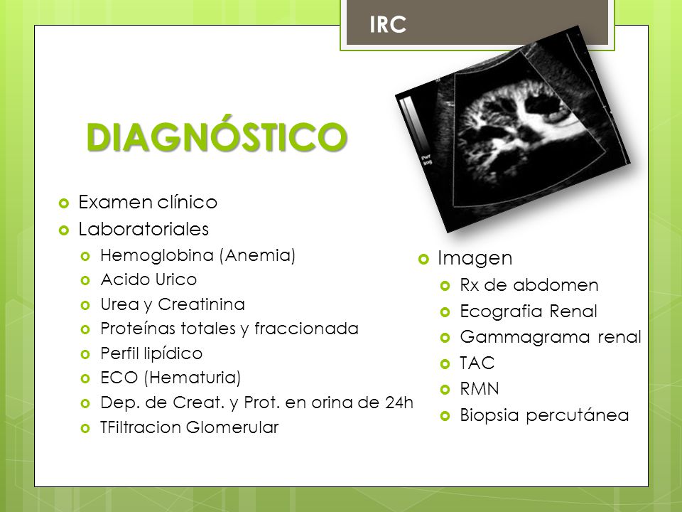 DIAGNÓSTICO IRC Imagen Examen clínico Laboratoriales Rx de abdomen