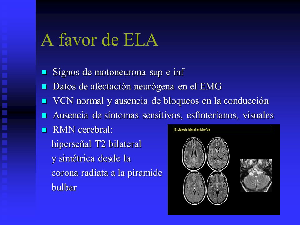 A favor de ELA Signos de motoneurona sup e inf