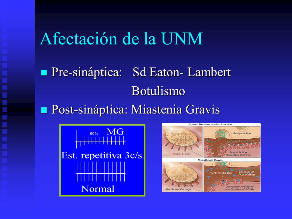 Afectación de la UNM Pre-sináptica: Sd Eaton- Lambert Botulismo
