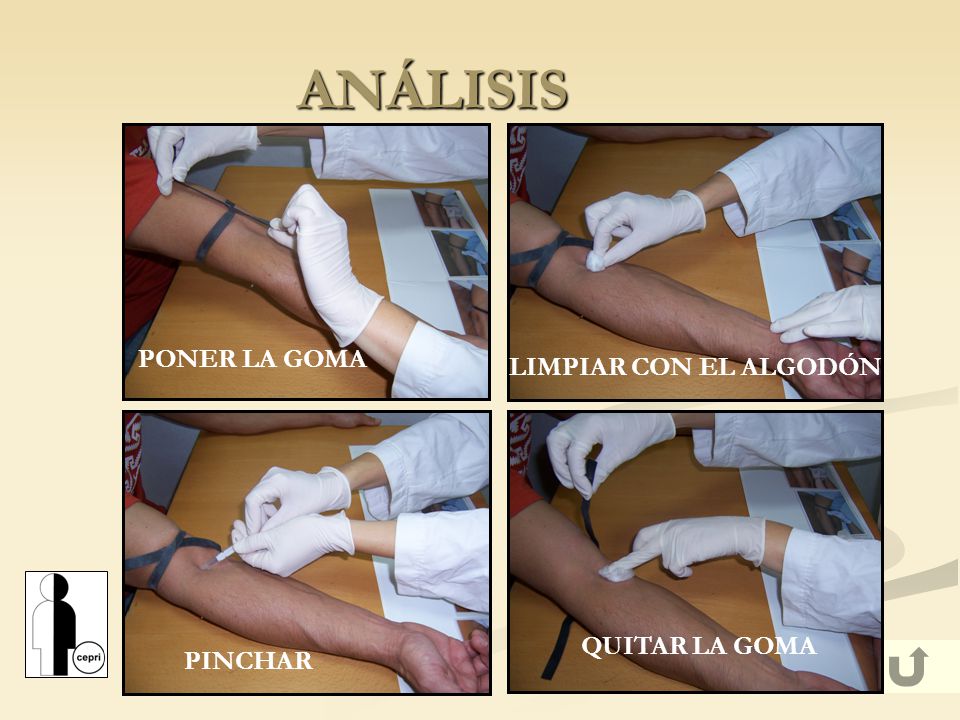 ANÁLISIS PONER LA GOMA LIMPIAR CON EL ALGODÓN QUITAR LA GOMA PINCHAR