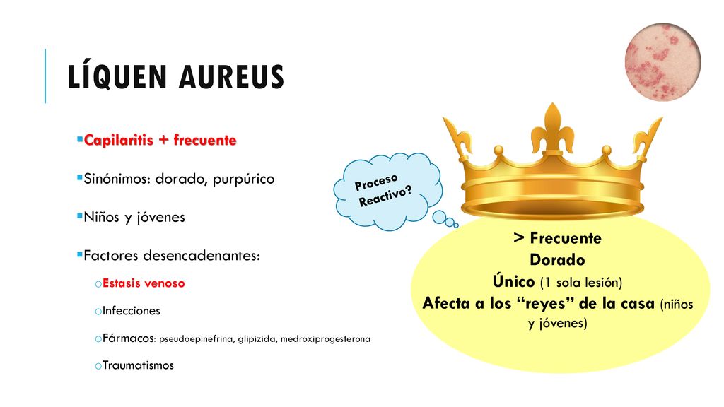 Afecta a los reyes de la casa (niños y jóvenes)