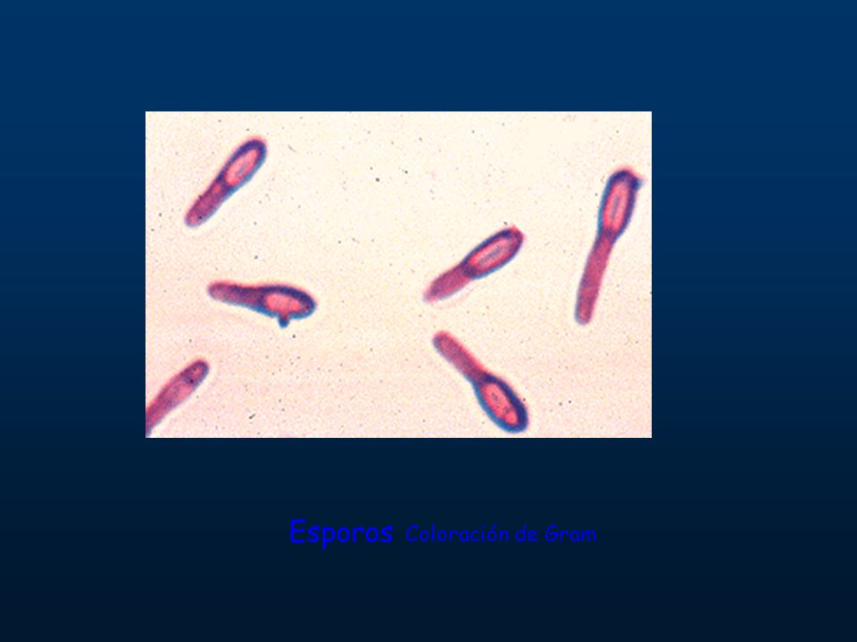 Esporos Coloración de Gram