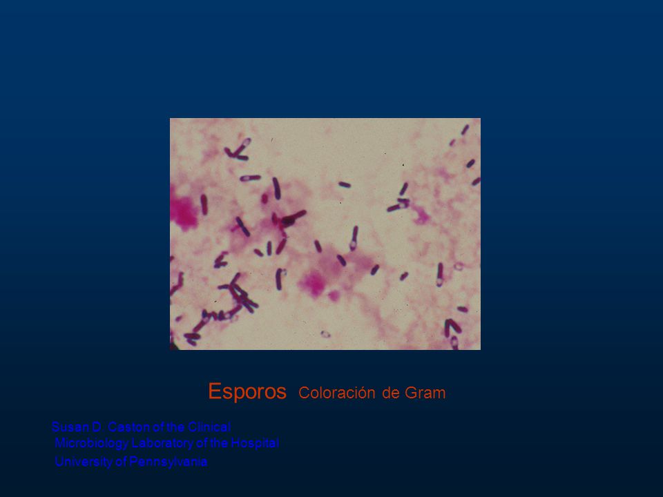 Esporos Coloración de Gram