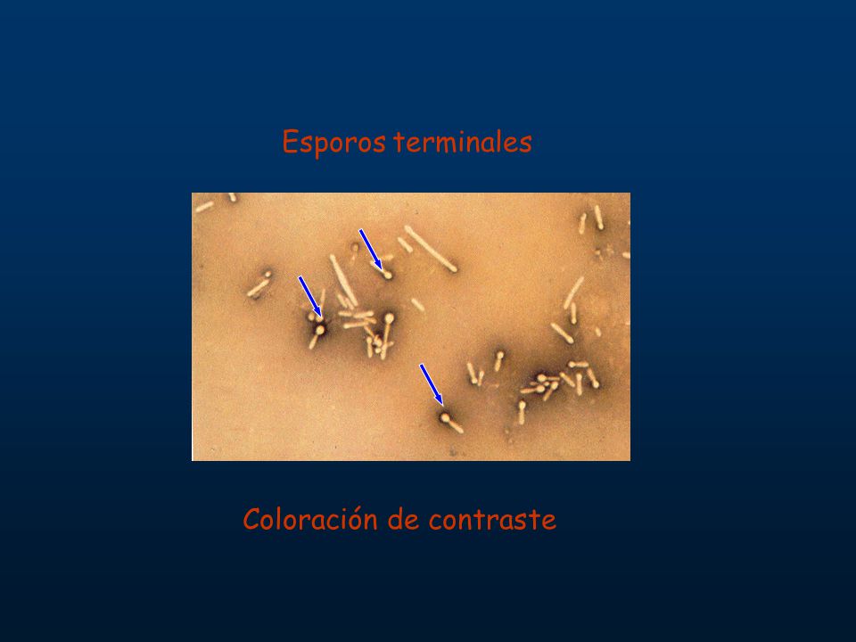 Esporos terminales Coloración de contraste