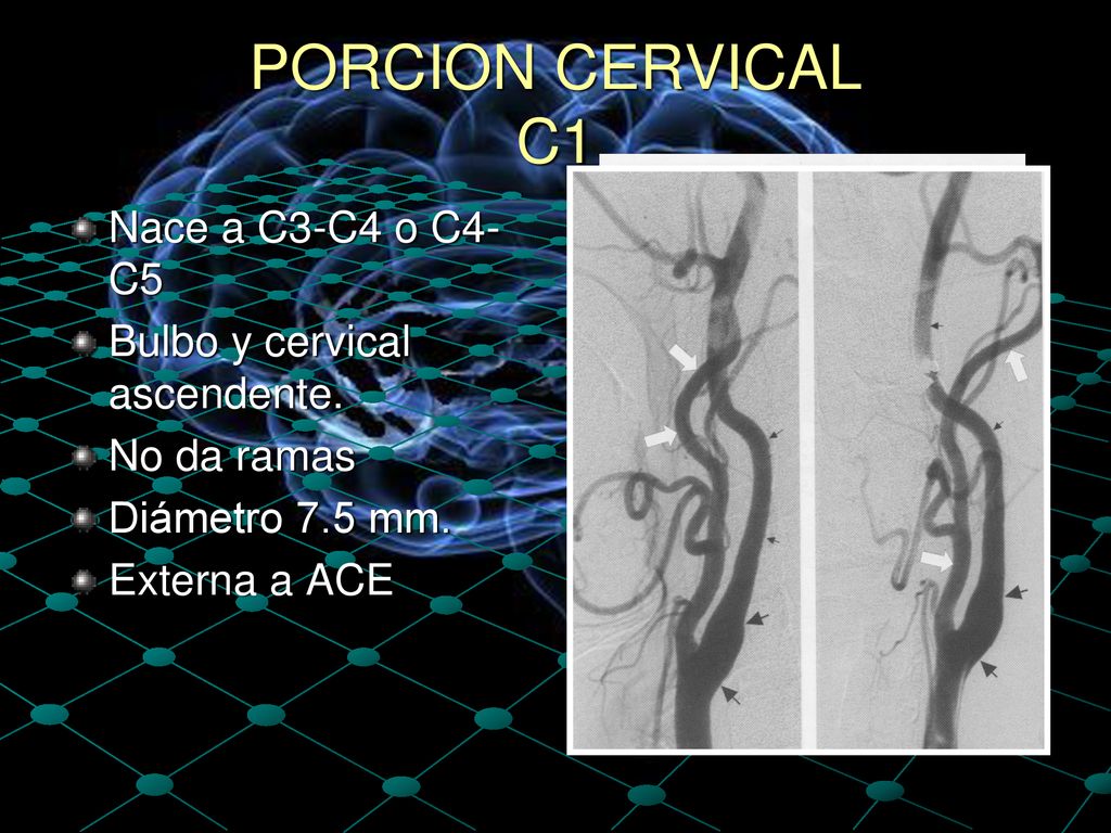 PORCION CERVICAL C1 Nace a C3-C4 o C4-C5 Bulbo y cervical ascendente.
