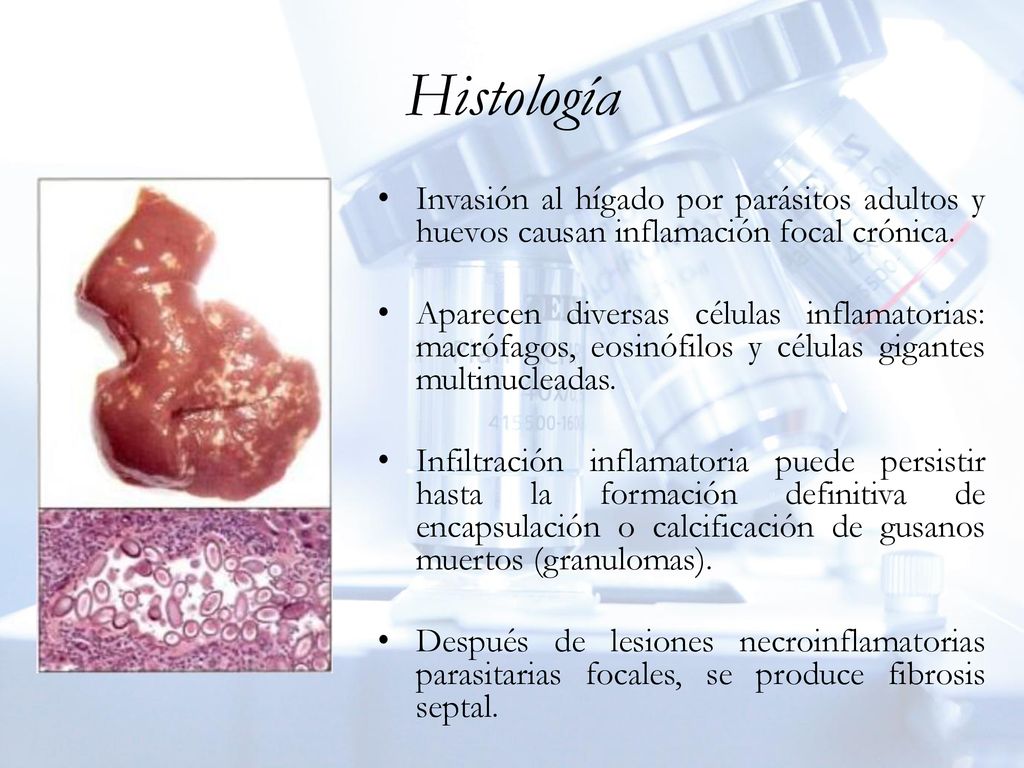 Histología Invasión al hígado por parásitos adultos y huevos causan inflamación focal crónica.
