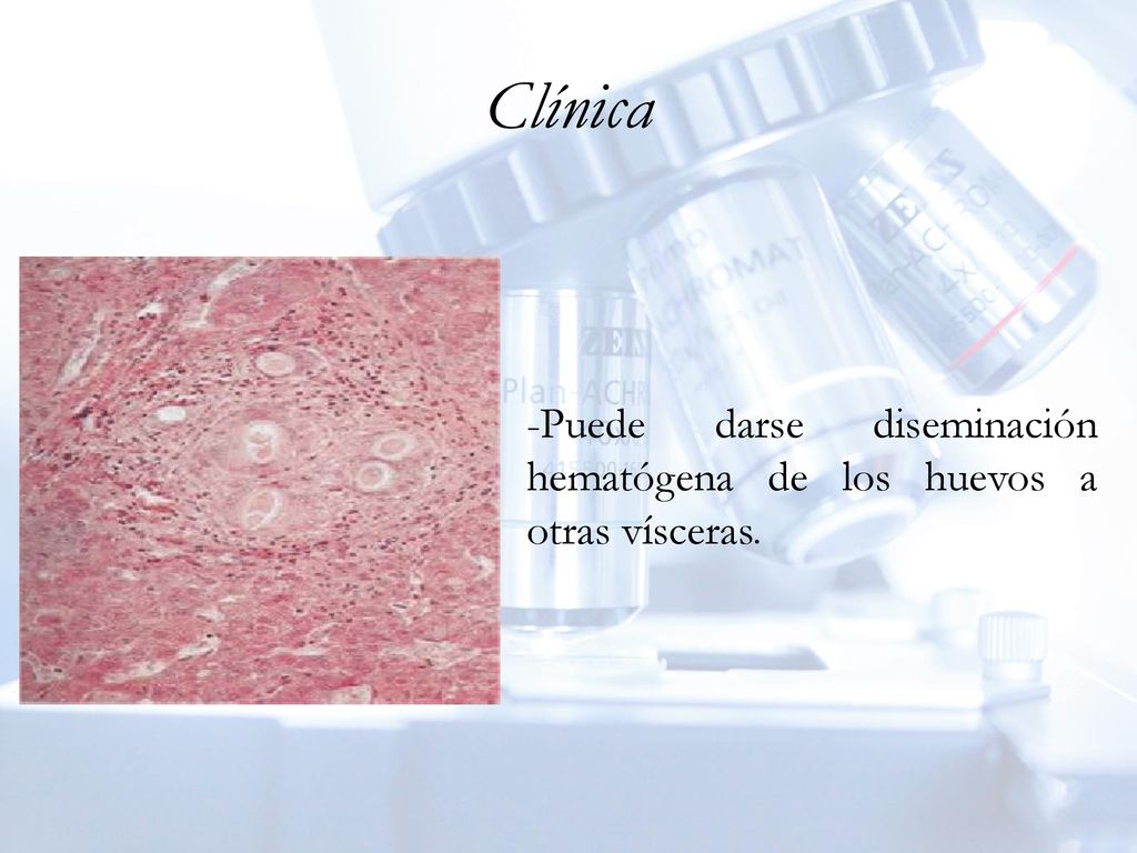 Clínica -Puede darse diseminación hematógena de los huevos a otras vísceras.